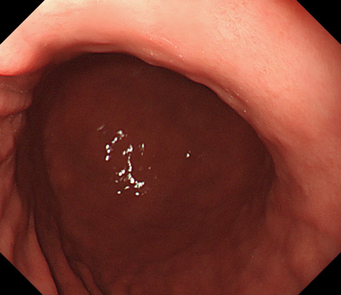 �̉������^